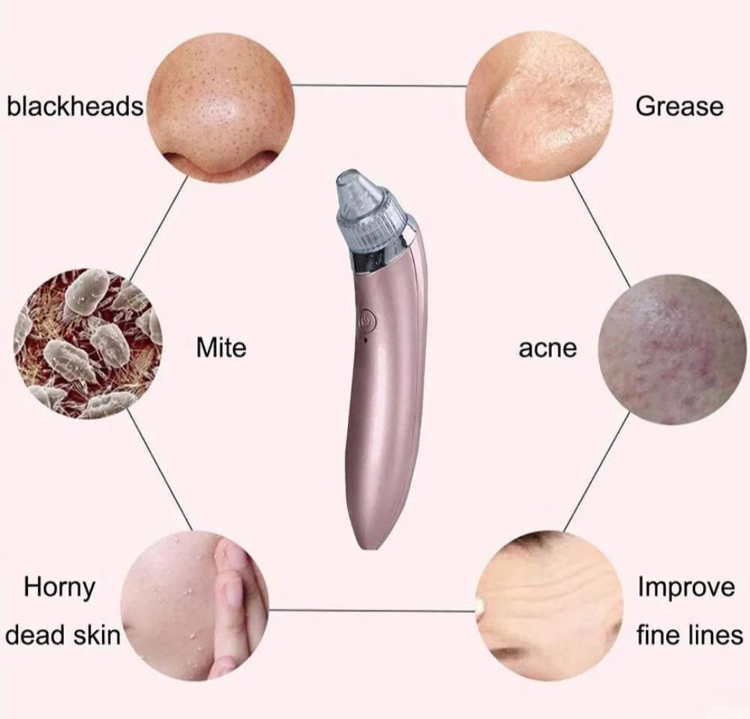 Maquina para eliminar puntos negros  FAINLIST