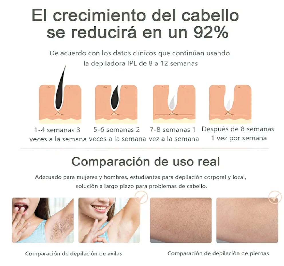 DEPILADOR LASER PREMIUM IPL